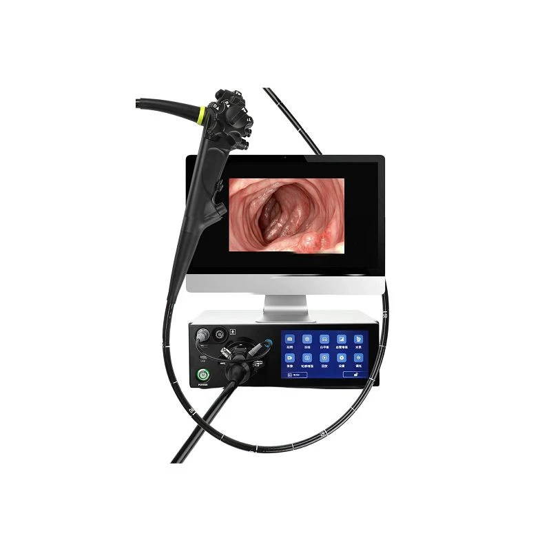 Digitálny gastroskop